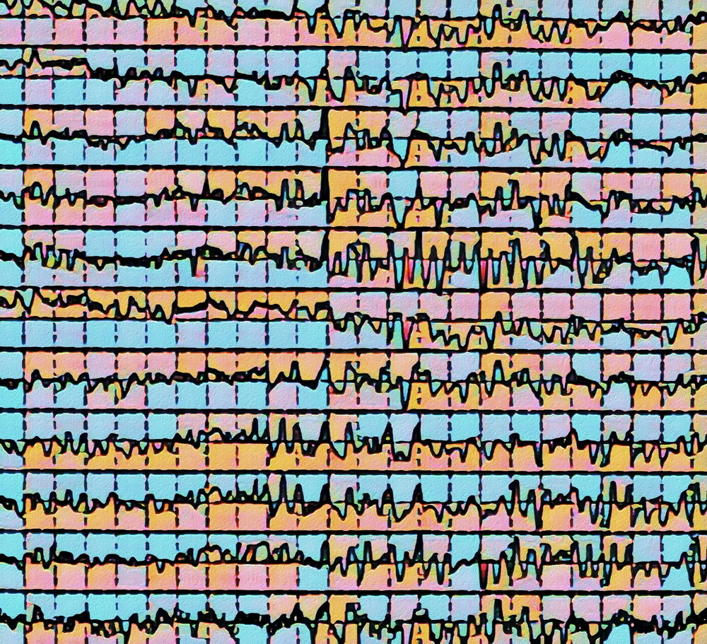 Sample of EEG brain-wave data (xpixel/Shutterstock)
